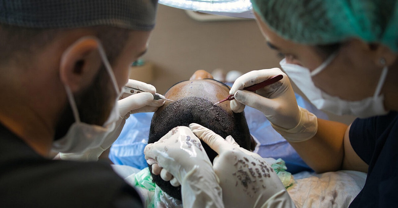 Forehead Reduction Surgery Explained: Procedure, Benefits, Risks, and Recovery